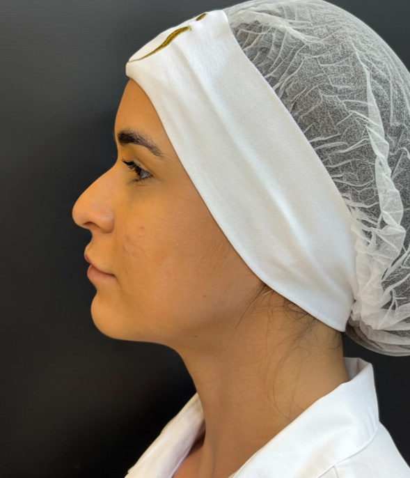 Foto Antes do Tratamento 2