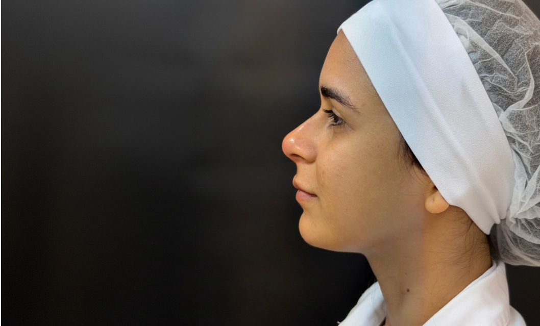 Foto Depois do Tratamento 2